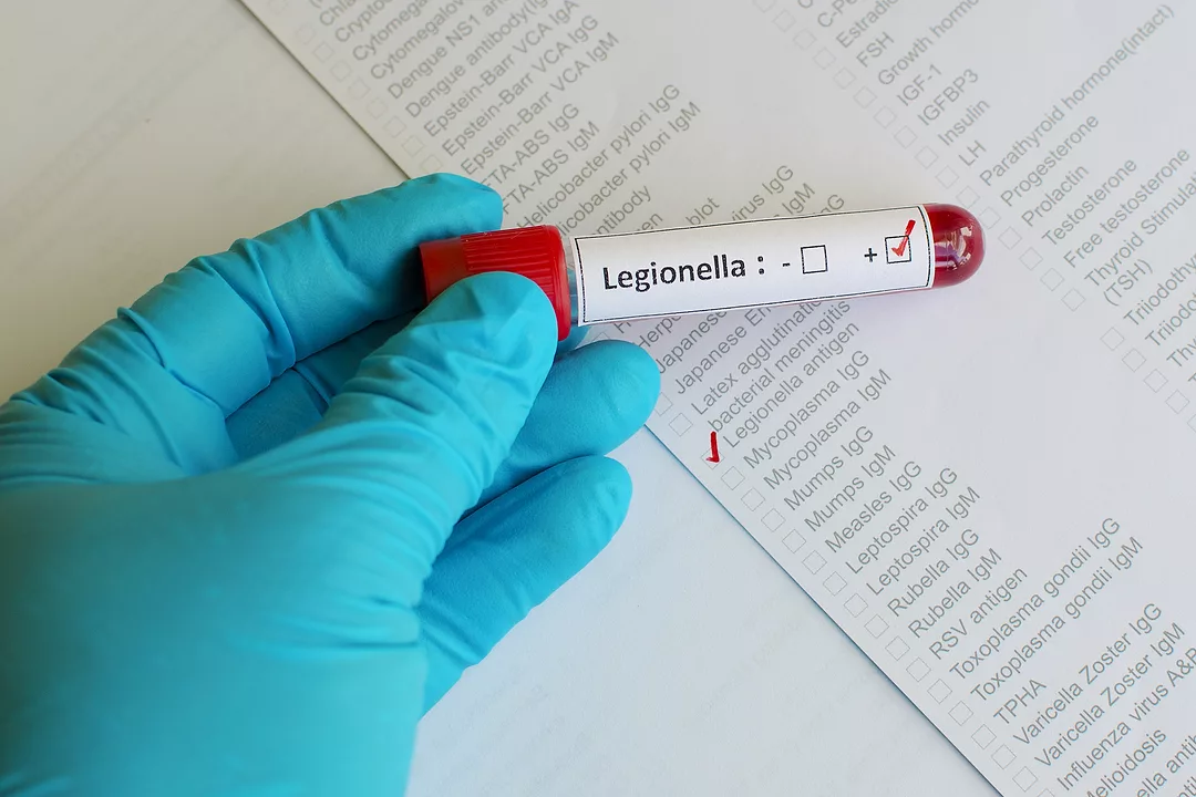 PE0821_Legionella-test.jpg