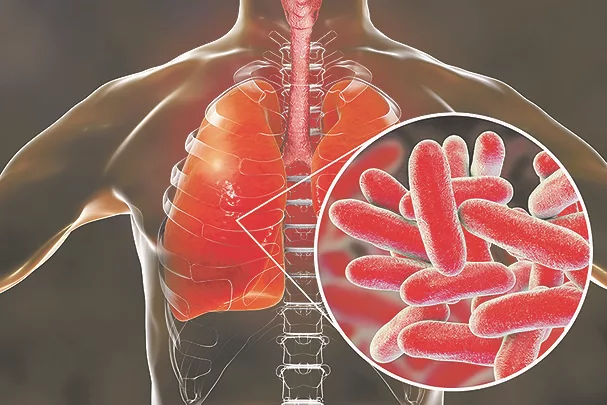 TW0225_Legionella 1.jpg