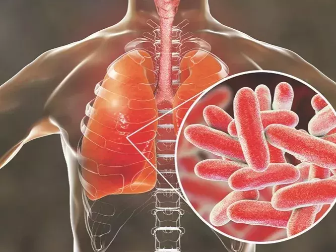 Minimizing Risk of Legionella Should Remain a Top Priority for Facility Managers.webp