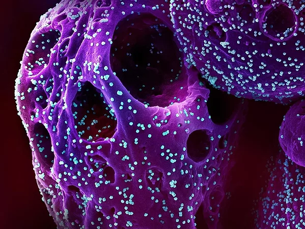 How Clinical Research is Helping People with Long COVID and Waste Water Surveillance Efforts.jpg